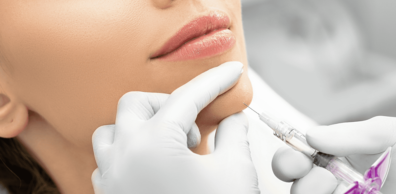 Biostimulators vs Dermal Fillers -