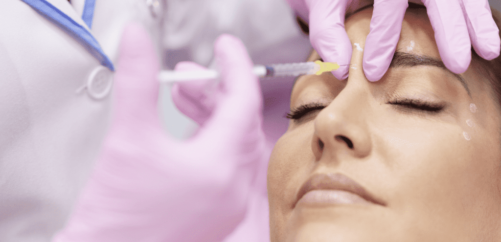 Botox for Forehead Lines and Crow’s Feet in Temecula