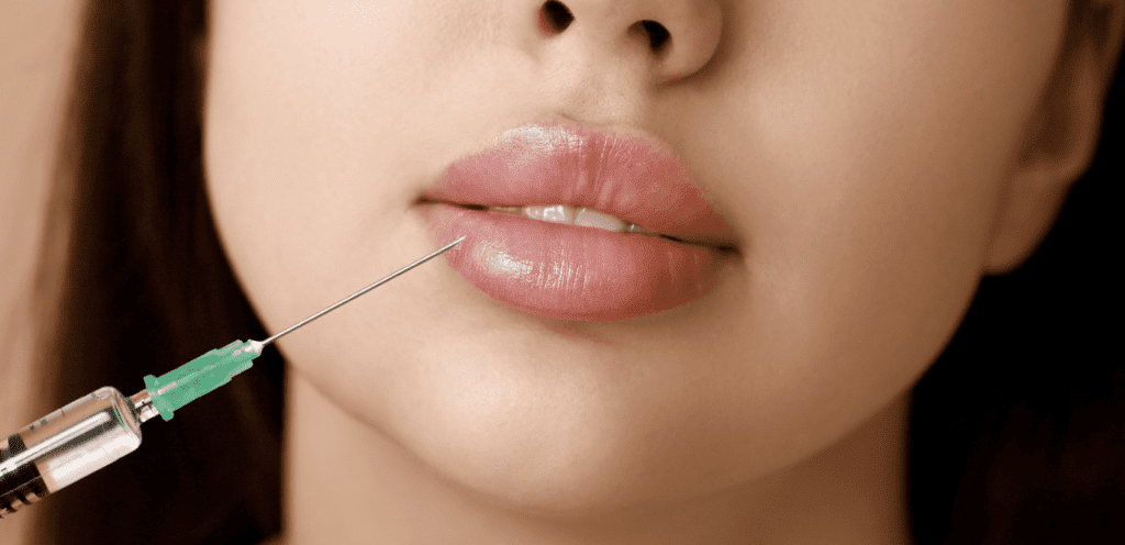 Affordable Lip Filler Options Available in Menifee