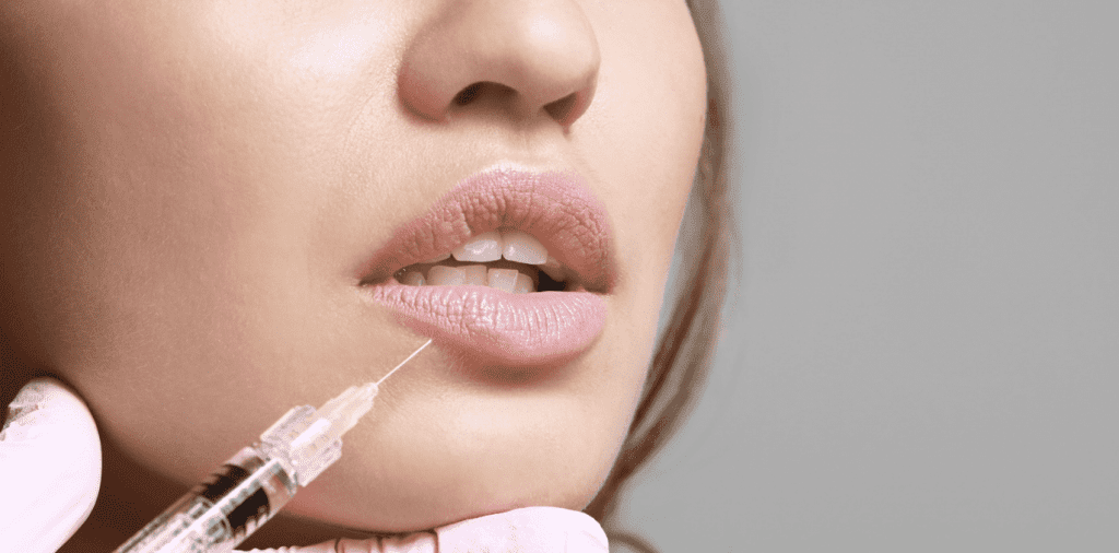 Top Clinic in Wildomar Offering Expert Lip Filler Treatments